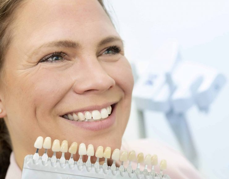 Zahnarzt Julia Kaiser Veneers