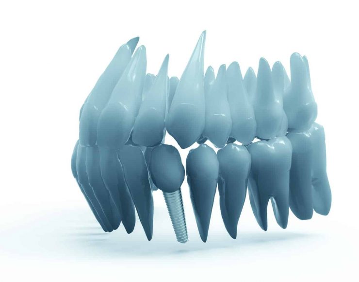 teeth-g465c0e4dd_1920